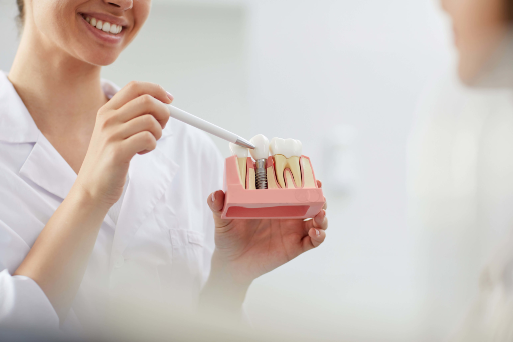 full mouth dental implants